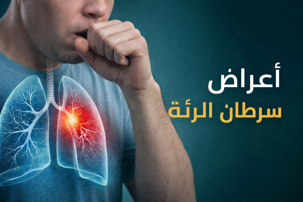 أعراض سرطان الرئة المبكرة مثل السعال وضيق التنفس