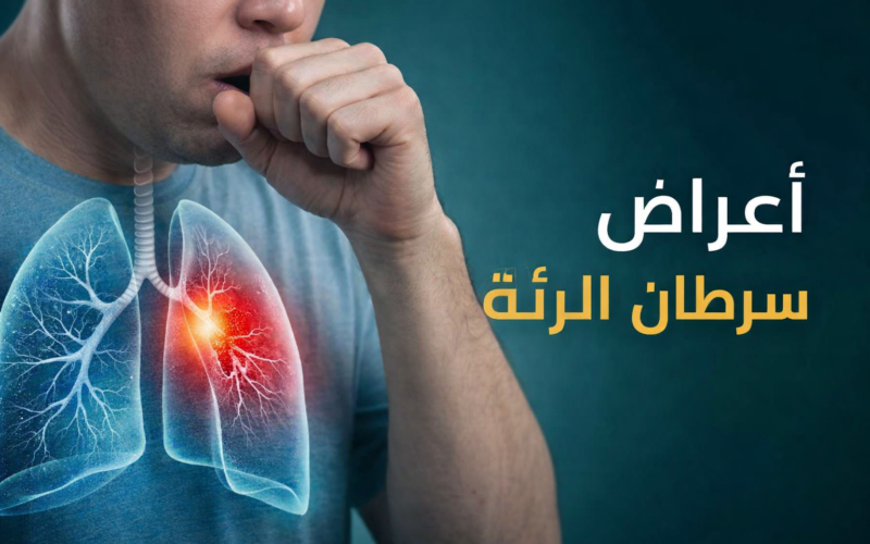 أعراض سرطان الرئة المبكرة: العلامات التي لا يجب تجاهلها